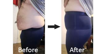 KROYWEN Men's High Waist Shapewear - Beige - Image 4